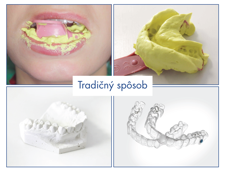 Egyedi 3D nyomtatóval rendelkezünk. Miért nagyszerű hír ez a pácienseink számára?