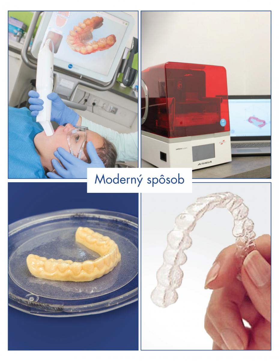 Egyedi 3D nyomtatóval rendelkezünk. Miért nagyszerű hír ez a pácienseink számára?