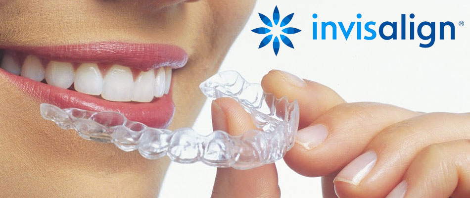 7 KROKOV K ROVNÝM ZUBOM S NEVIDITEĽNÝM APARÁTOM INVISALIGN  