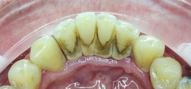  Egészséges és ragyogó fogak fájdalom nélkül
