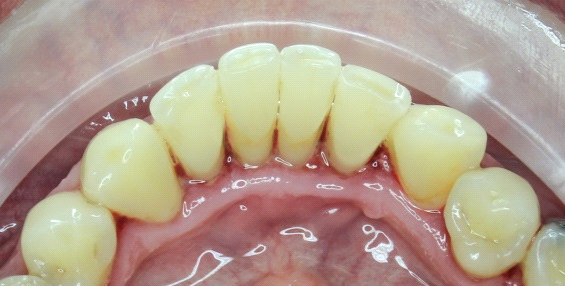  Egészséges és ragyogó fogak fájdalom nélkül