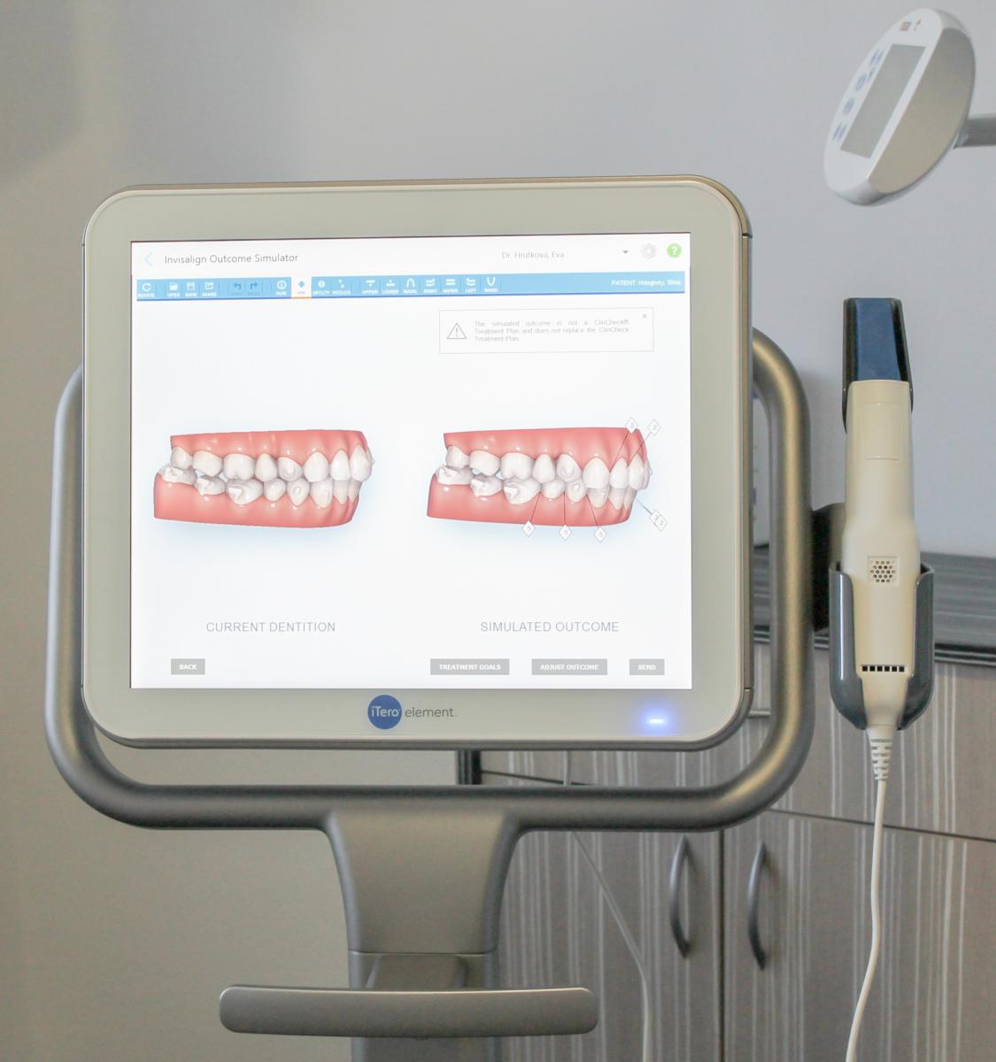 7 KROKOV K ROVNÝM ZUBOM S NEVIDITEĽNÝM APARÁTOM INVISALIGN  