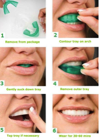 9 egyszerű lépéssel a fehérebb fogakért Article szerkesztése