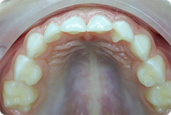 obrázok ideálne detské zuby