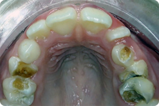 obrázok detské zuby