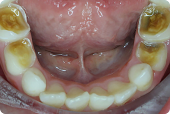 obrázok detské zuby