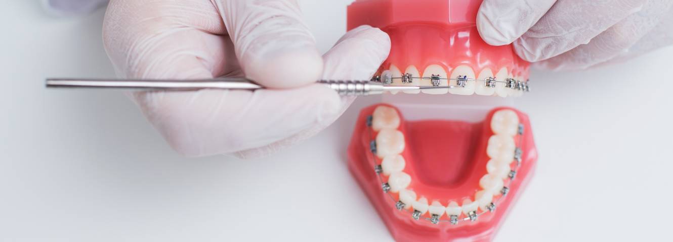 Kovový fixný strojček