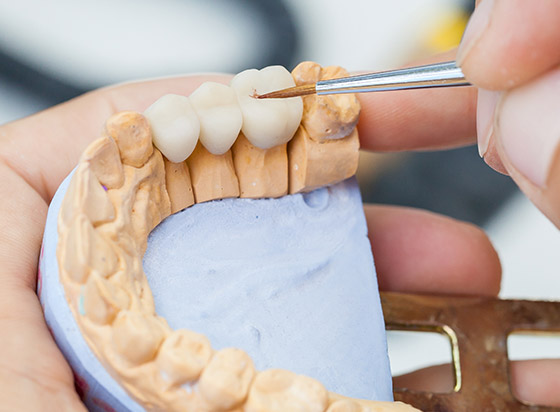 Protetická stomatológia