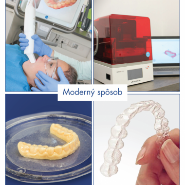 Egyedi 3D nyomtatóval rendelkezünk. Miért nagyszerű hír ez a pácienseink számára?