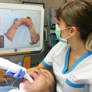 Videó a fogak szkenneléséről