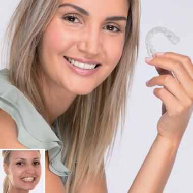 3 mýty o zubných strojčekoch